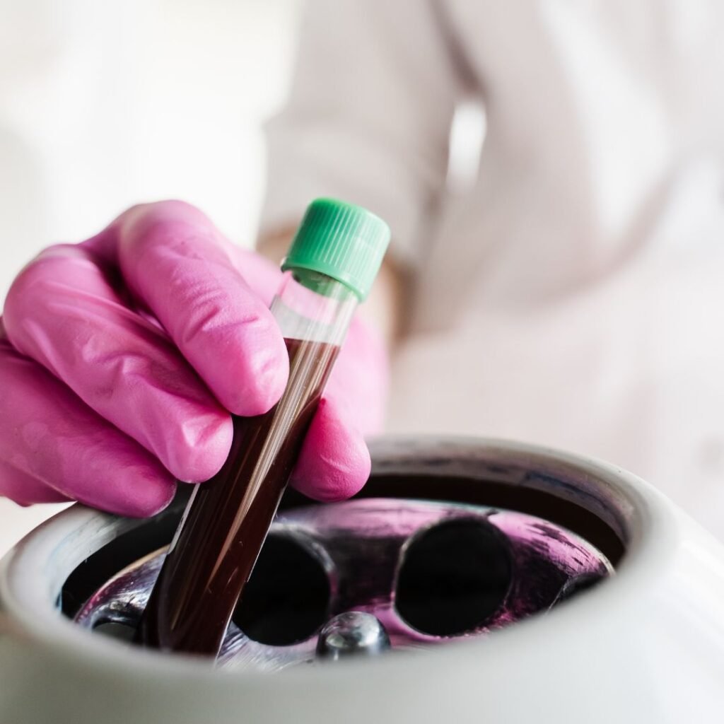 Simak Hukum Penggunaan Plasma Darah Untuk Bahan Obat!